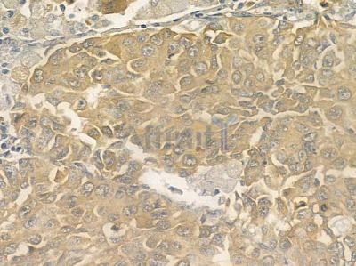 TAF7L Antibody - DF2403 at 1/100 staining human normal kidney tissue by IHC-P.