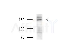 SNAPC4 Antibody - Western blot analysis of extracts from MCF7 cells(heat-shock treatment), using SNAPC4 Antibody at 1/1000 dilution.