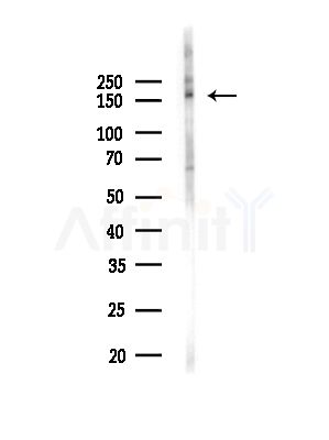SNAPC4 Antibody - Western blot analysis of lysates from MCF7 cells(heat-shock,45min treatment), using SNAPC4 Antibody at 1/1000 dilution.