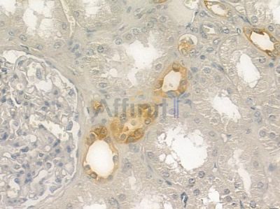 Torc1/Crtc1 Antibody - DF2415 at 1/100 staining human normal kidney tissue by IHC-P.