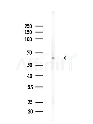 ZNF497 Antibody - Western blot analysis of lysates from Rat lung, using ZNF497 Antibody at 1/1000 dilution.