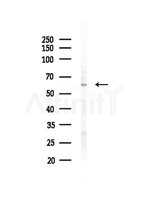 ZNF497 Antibody - Western blot analysis of lysates from HUVEC cells(starvation,24h treatment), using ZNF497 Antibody at 1/1000 dilution.