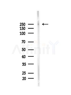 JMJD1B Antibody - Western blot analysis of lysates from Mouse brain, using JMJD1B Antibody at 1/1000 dilution.