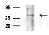 Virion infectivity factor Antibody - Western blot analysis of extracts from HepG2 cells(starvation treatment), using Virion infectivity factor Antibody at 1/1000 dilution.