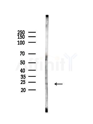 Virion infectivity factor Antibody - Western blot analysis of lysates from HepG2 cells(starvation treatment), using Virion infectivity factor Antibody at 1/1000 dilution.