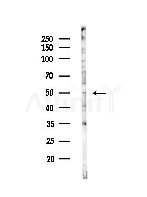 TFAP2D Antibody - Western blot analysis of lysates from HUVEC cells(starvation,24h treatment), using TFAP2D Antibody at 1/1000 dilution.