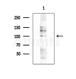ZFPM1 Antibody - Western blot analysis of extracts from HepG2 cells(LPS 4h treatment), using ZFPM1 Antibody at 1/1000 dilution.