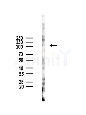 ZFPM1 Antibody - Western blot analysis of lysates from HepG2 cells(LPS,4h treatment), using ZFPM1 Antibody at 1/1000 dilution.
