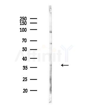 MKX Antibody - Western blot analysis of lysates from COLO205 cells(UV,30min treatment), using MKX Antibody at 1/1000 dilution.