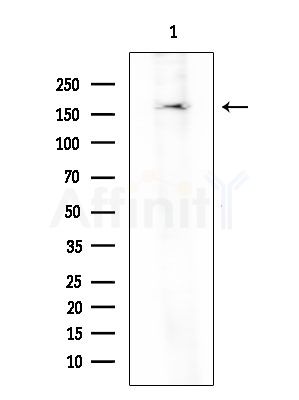 XRN1 Antibody - Western blot analysis of extracts from HUVEC cells, using XRN1 Antibody at 1/1000 dilution.