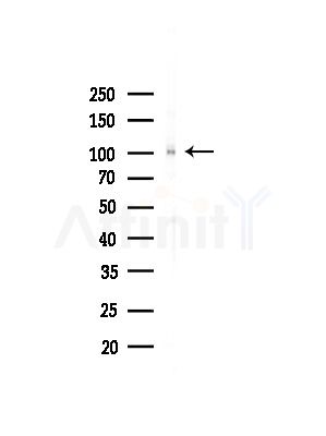 MYOCD Antibody - Western blot analysis of lysates from COLO205 cells(UV,30min treatment), using MYOCD Antibody at 1/1000 dilution.