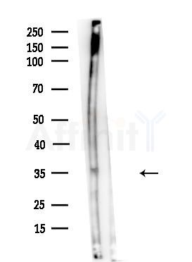 CPXCR1 Antibody - Western blot analysis of lysates from Mouse brain, using CPXCR1 Antibody at 1/1000 dilution.