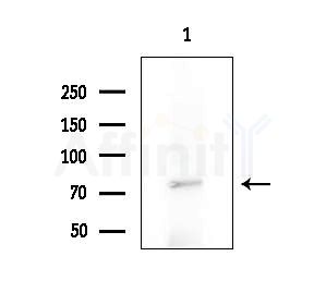 ZNF709 Antibody - Western blot analysis of extracts from A375 cells(starvation treatment), using ZNF709 Antibody at 1/1000 dilution.
