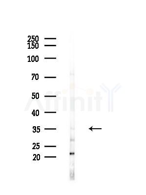 SNAPC3 Antibody - Western blot analysis of lysates from LoVo cells(heat-shock,45min treatment), using SNAPC3 Antibody at 1/1000 dilution.