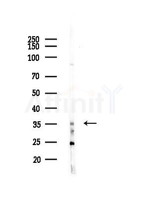 SNAPC3 Antibody - Western blot analysis of lysates from HUVEC cells(LPS,4h treatment), using SNAPC3 Antibody at 1/1000 dilution.