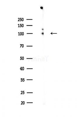 E2F7 Antibody - Western blot analysis of lysates from A375 cells(LPS,4h treatment), using E2F7 Antibody at 1/1000 dilution.