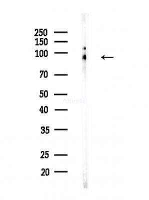 E2F7 Antibody - Western blot analysis of lysates from Hela cells(heat-shock,45min treatment), using E2F7 Antibody at 1/1000 dilution.