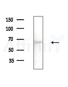 ZNF768 Antibody - Western blot analysis of extracts from Rat brain, using ZNF768 Antibody at 1/1000 dilution.