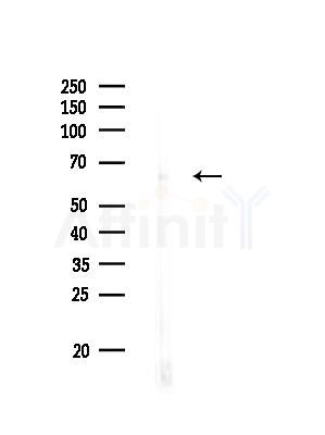 ZNF768 Antibody - Western blot analysis of lysates from Rat brain, using ZNF768 Antibody at 1/1000 dilution.