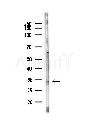 VSIG2 Antibody - Western blot analysis of lysates from LoVo cells(heat-shock,45min treatment), using VSIG2 Antibody at 1/1000 dilution.