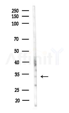 ALKBH3 Antibody - Western blot analysis of lysates from B16F10-LUC cells(starvation,24h treatment), using ALKBH3 Antibody at 1/1000 dilution.