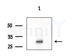 CITED4 Antibody - Western blot analysis of extracts from COLO205 cells, using CITED4 Antibody at 1/1000 dilution.