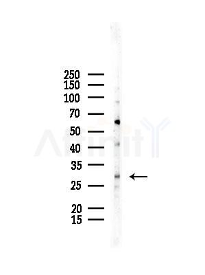 CITED4 Antibody - Western blot analysis of lysates from COLO205 cells, using CITED4 Antibody at 1/1000 dilution.
