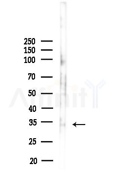 ROAA Antibody - Western blot analysis of lysates from Mouse lung, using ROAA Antibody at 1/1000 dilution.