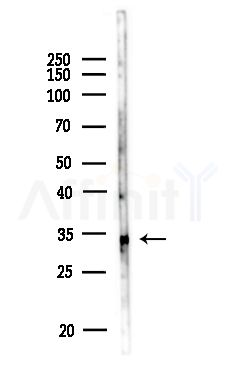 ROAA Antibody - Western blot analysis of lysates from MDA-MB-231 cells(heat-shock,45min treatment), using ROAA Antibody at 1/1000 dilution.
