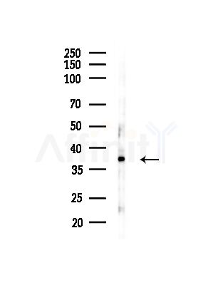 EBP2 Antibody - Western blot analysis of lysates from Hela cells(starvation,24h treatment), using EBP2 Antibody at 1/1000 dilution.