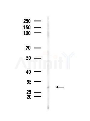 CITED2 Antibody - Western blot analysis of lysates from Mouse muscle, using CITED2 Antibody at 1/1000 dilution.