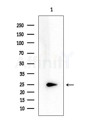 T106C Antibody - Western blot analysis of extracts from COLO205 cells, using T106C Antibody at 1/1000 dilution.