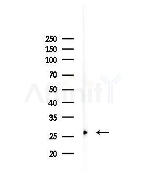 T106C Antibody - Western blot analysis of lysates from COLO205 cells, using T106C Antibody at 1/1000 dilution.