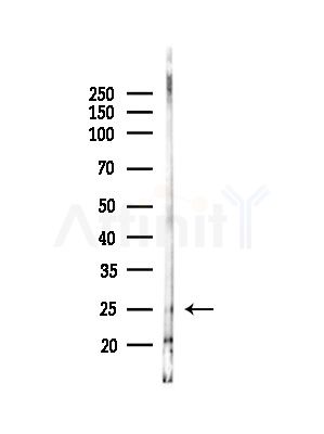 MIXL1 Antibody - Western blot analysis of lysates from COLO205 cells(UV,30min treatment), using MIXL1 Antibody at 1/1000 dilution.