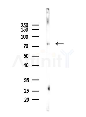 RBM35B Antibody - Western blot analysis of lysates from Mouse lung, using RBM35B Antibody at 1/1000 dilution.