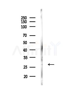 MOBKL1B Antibody - Western blot analysis of lysates from COLO205 cells, using MOBKL1B Antibody at 1/1000 dilution.