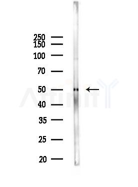 ZNF71 Antibody - Western blot analysis of lysates from Mouse lung, using ZNF71 Antibody at 1/1000 dilution.