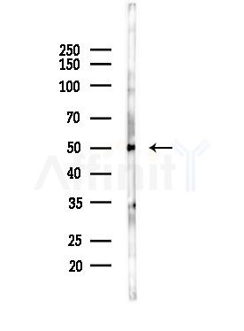 ZNF71 Antibody - Western blot analysis of lysates from LoVo cells(heat-shock,45min treatment), using ZNF71 Antibody at 1/1000 dilution.