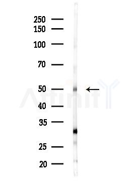 ZNF71 Antibody - Western blot analysis of lysates from MDA-MB-231 cells(heat-shock,45min treatment), using ZNF71 Antibody at 1/1000 dilution.