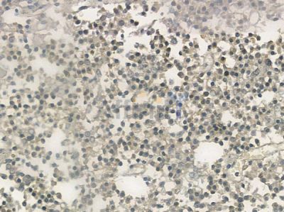 ZNF71 Antibody - DF2474 at 1/100 staining human pituitary adenoma by IHC-P.