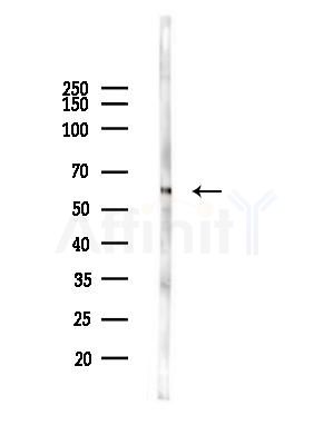 BIN2 Antibody - Western blot analysis of lysates from HUVEC cells(LPS,4h treatment), using BIN2 Antibody at 1/1000 dilution.