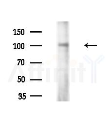 INT6 Antibody - Western blot analysis of extracts from LoVo cells(heat-shock,45min treatment), using INT6 Antibody at 1/1000 dilution.