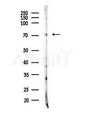 TNF18 Antibody - Western blot analysis of lysates from MDA-MB-231 cells(heat-shock,45min treatment), using TNF18 Antibody at 1/1000 dilution.