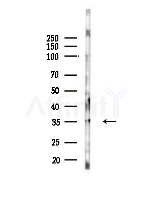 TSSC4 Antibody - Western blot analysis of lysates from Hela cells(starvation,24h treatment), using TSSC4 Antibody at 1/1000 dilution.