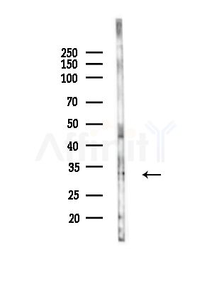 TSSC4 Antibody - Western blot analysis of lysates from PC12 cells(LPS,4h treatment), using TSSC4 Antibody at 1/1000 dilution.