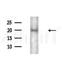 FAIM1 Antibody - Western blot analysis of extracts from HUVEC cells(LPS,4h treatment), using FAIM1 Antibody at 1/1000 dilution.