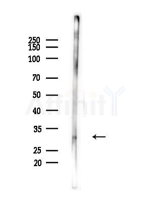 FGF12 Antibody - Western blot analysis of lysates from COLO205 cells(heat-shock,45min treatment), using FGF12 Antibody at 1/1000 dilution.