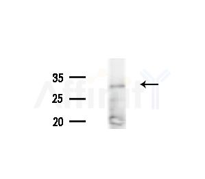 FGF14 Antibody - Western blot analysis of extracts from A375 cells(heat-shock treatment), using FGF14 Antibody at 1/1000 dilution.