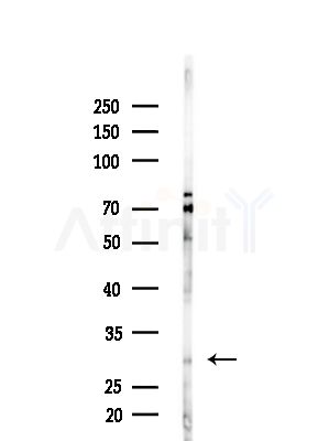 FGF14 Antibody - Western blot analysis of lysates from A375 cells(heat-shock,45min treatment), using FGF14 Antibody at 1/1000 dilution.