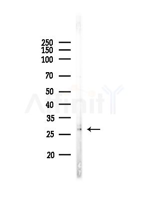 FGF8 Antibody - Western blot analysis of lysates from Rat liver, using FGF8 Antibody at 1/1000 dilution.